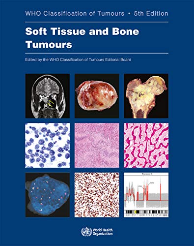 WHO classification of tumours of soft tissue and bone tumours (World Health Organization Classification of Tumours)