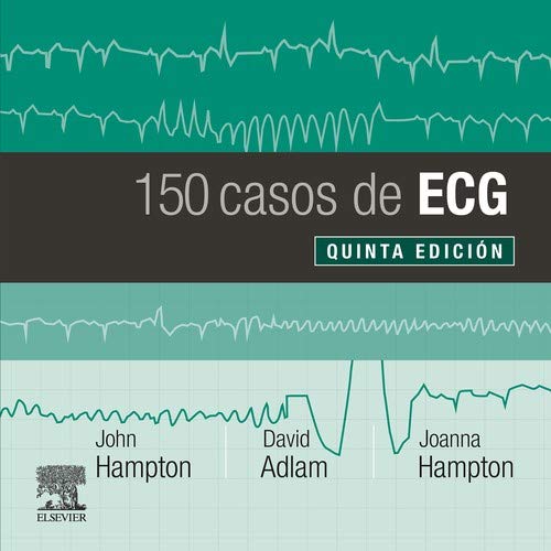 150 Casos De Ecg - 5ª Edición