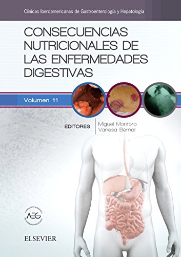 Consecuencias nutricionales de las enfermedades digestivas: Clínicas Iberoamericanas de Gastroenterología y Hepatología vol.11
