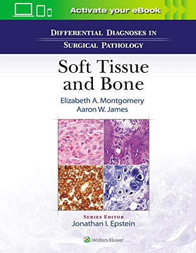 DIFFERENTIAL DIAGNOSES IN SURGICAL PATHOLOGY SOFT TISSUE