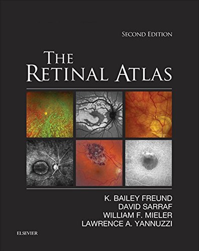 The Retinal Atlas E-Book (English Edition)