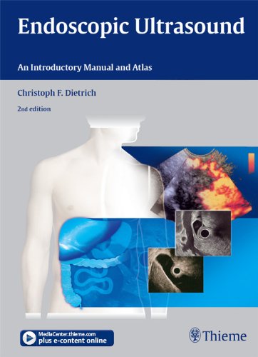 Endoscopic Ultrasound: An Introductory Manual and Atlas (English Edition)