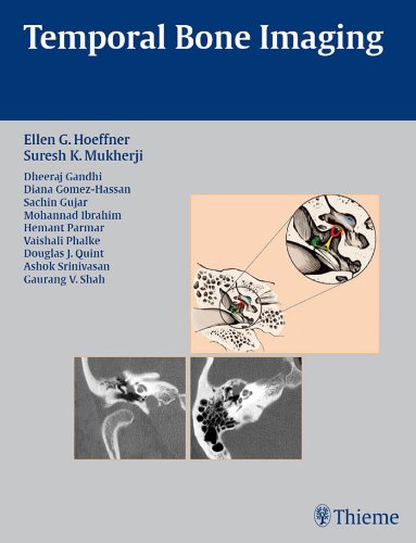 Temporal Bone Imaging (English Edition)