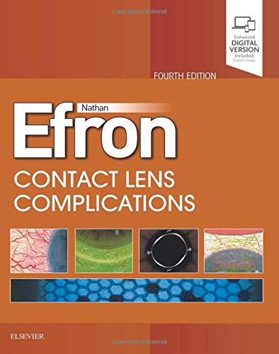 Contact Lens Complications, 4e: Expert Consult - Online and Print