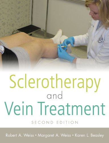 Sclerotherapy and Vein Treatment, Second Edition SET (English Edition)