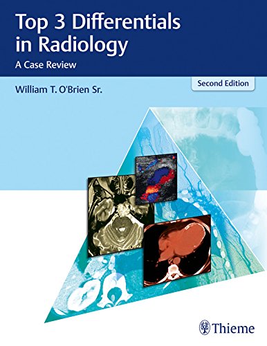 Top 3 Differentials in Radiology: A Case Review (English Edition)