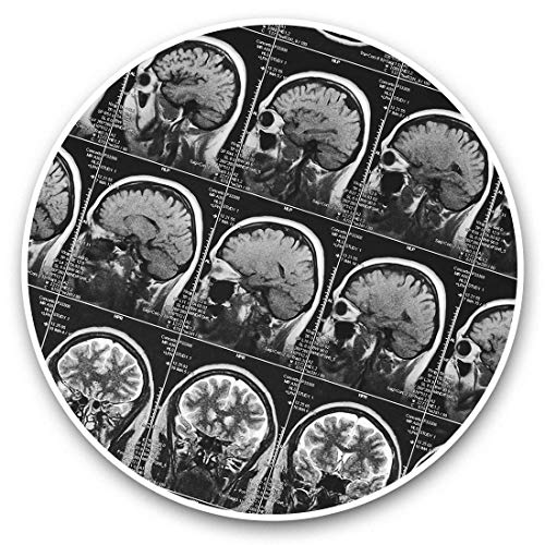 Impresionantes pegatinas de vinilo (juego de 2) 25 cm bw – MRI Brain Scan X-Ray imágenes calcomanías divertidas para portátiles, tabletas, equipaje, reserva de chatarras, frigoríficos, regalo genial #43261