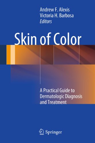 Skin of Color: A Practical Guide to Dermatologic Diagnosis and Treatment (English Edition)