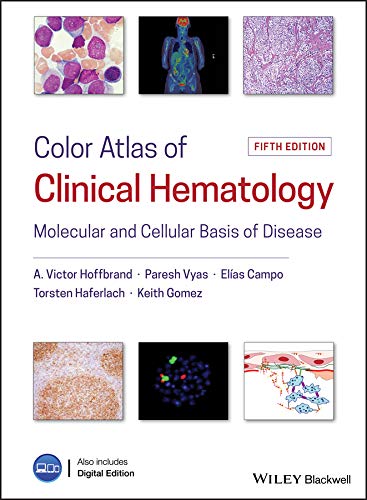 Color Atlas of Clinical Hematology: Molecular and Cellular Basis of Disease (English Edition)