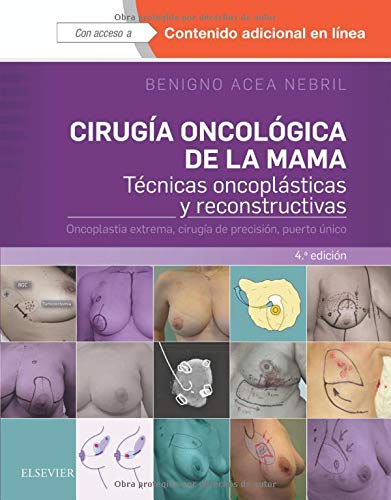 Cirugía oncológica de la mama - 4ª edición