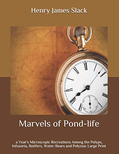 Marvels of Pond-life: a Year's Microscopic Recreations Among the Polyps, Infusoria, Rotifers, Water-Bears and Polyzoa: Large Print