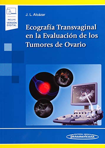Ecografía Transvaginal en la Evaluación de los Tumores de Ovario