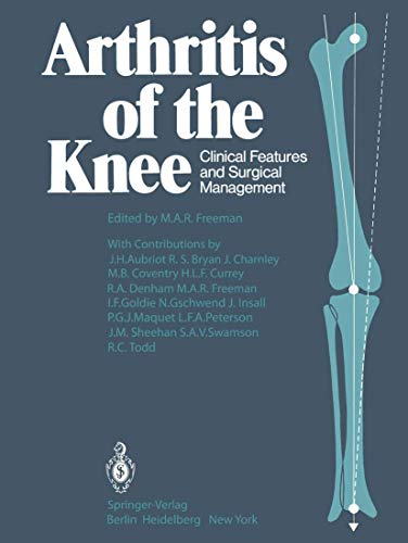 Arthritis of the Knee: Clinical Features and Surgical Management