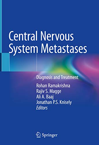 Central Nervous System Metastases: Diagnosis and Treatment (English Edition)