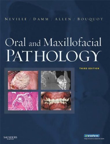 Oral and Maxillofacial Pathology - E-Book (English Edition)