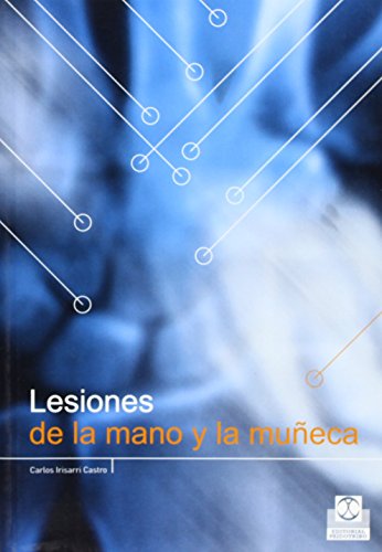 Lesiones de la mano y la muñeca de Carlos Irisarri Castro (3 feb 2005) Tapa blanda