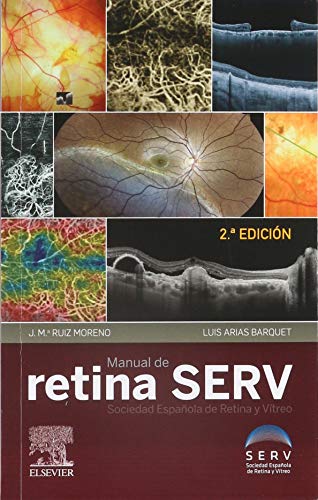 Manual De Retina Serv - 2ª Edición