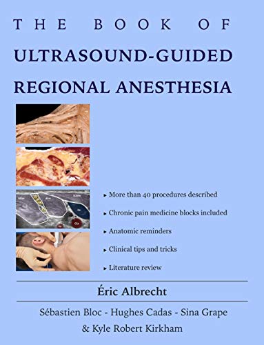 The BOOK of Ultrasound-Guided Regional Anesthesia (English Edition)