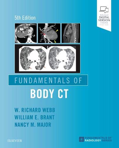 Fundamentals of Body CT, 5e (Fundamentals of Radiology)