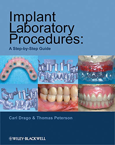Implant Laboratory Procedures