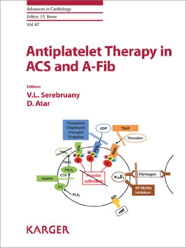 Antiplatelet Therapy in ACS and A-Fib (Advances in Cardiology Book 47) (English Edition)