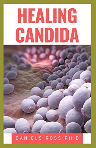 HEALING CANDIDA: Healthy,Holistic,Comprehensive,Natural Treatment Approach to Curing and Healing Candidiasis Infection