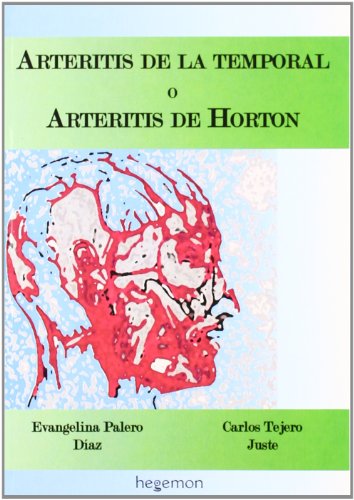 Arteritis de la temporal o arteritis de horton