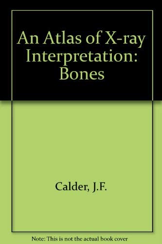 An Atlas of X-ray Interpretation: Bones