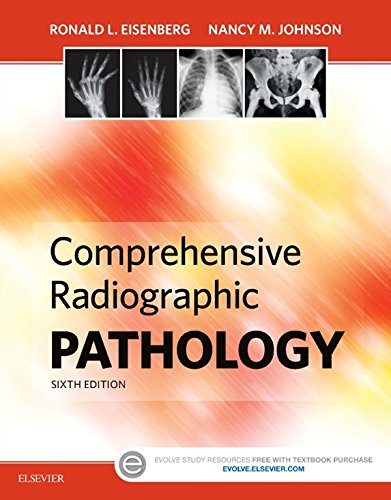 Comprehensive Radiographic Pathology - E-Book (English Edition)