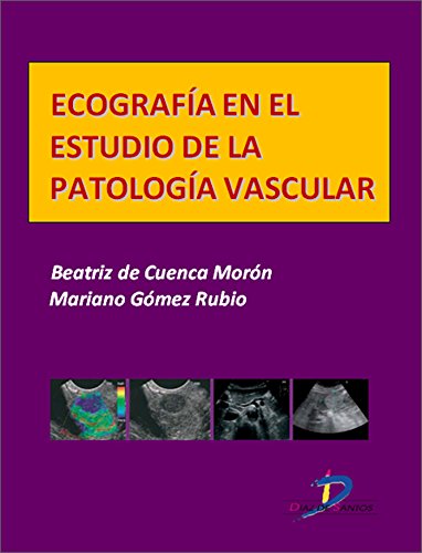 Ecografía en el estudio de la patología vascular  (Este capítulo pertenece al libro Tratado de ultrasonografía abdominal)