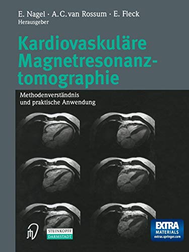 Kardiovaskulare Magnetresonanztomographie: Methodenverstandnis Und Praktische Anwendung