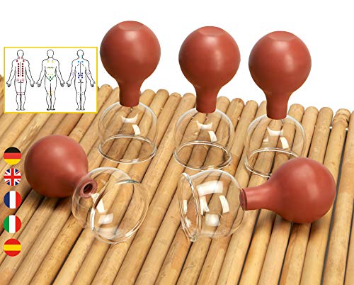 Lunata SET 5x Juego de Ventosas con Bola de Succión, Ø 50, Ventosa anticelulitica, Ventosas para un Masaje profesional Lunata SET 5x Juego de Ventosas con Bola de Succión, Ø 50, Ventosa anticelulitica, Ventosas para un Masaje profesional