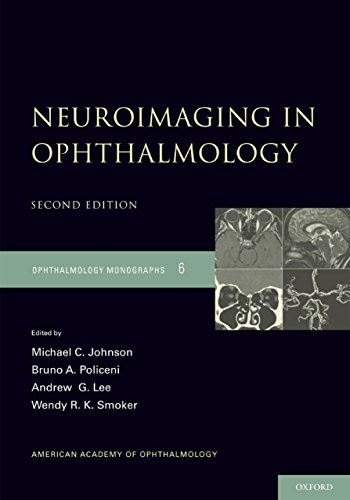 Neuroimaging in Ophthalmology (American Academy of Ophthalmology Monograph Series Book 6) (English Edition)