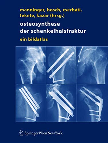 Osteosynthese der Schenkelhalsfraktur: Ein Bildatlas