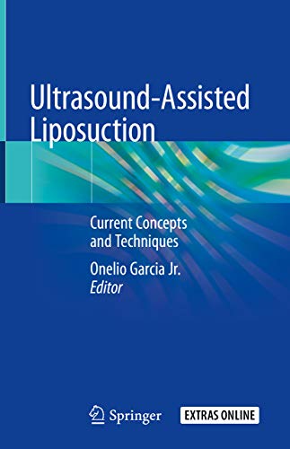 Ultrasound-Assisted Liposuction: Current Concepts and Techniques (English Edition)
