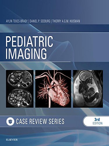 Pediatric Imaging: Case Review E-Book (English Edition)