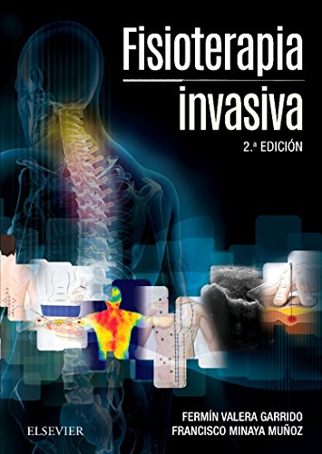 Fisioterapia Invasiva + Acceso Web - 2ª Edición Fisioterapia Invasiva + Acceso Web - 2ª Edición