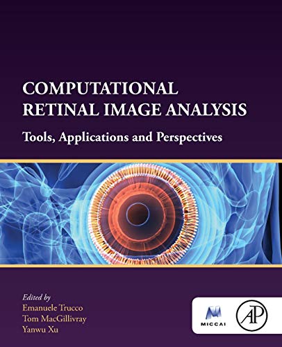 Computational Retinal Image Analysis: Tools, Applications and Perspectives (The MICCAI Society book Series)