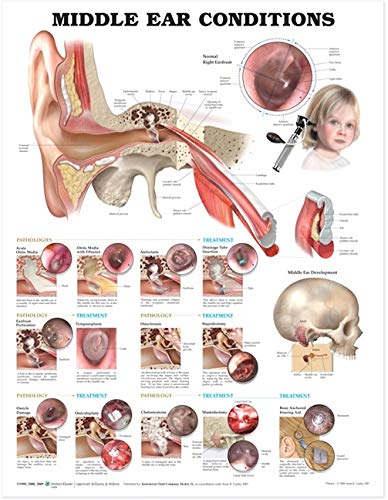 Tabla anatómica de condiciones del oído medio