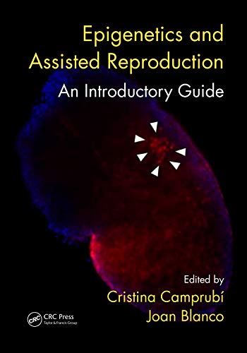 Epigenetics and Assisted Reproduction: An Introductory Guide (English Edition)