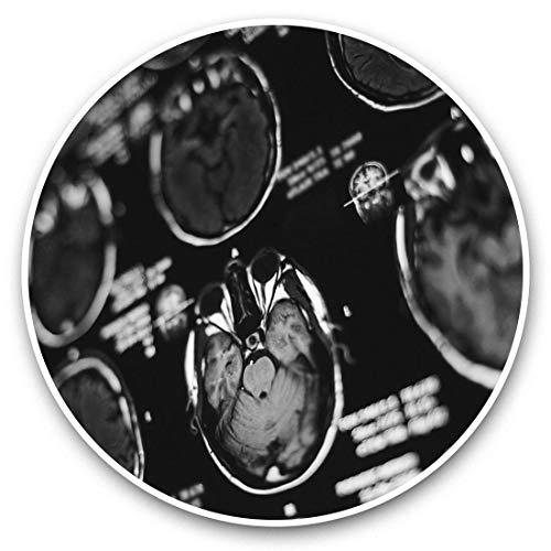 Impresionantes pegatinas de vinilo (juego de 2) 25 cm bw – MRI Brain Scan X-Ray imágenes calcomanías divertidas para portátiles, tabletas, equipaje, reserva de chatarras, frigoríficos, regalo genial #43166