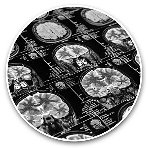 Impresionantes pegatinas de vinilo (juego de 2) 25 cm bw – MRI Brain Scan X-Ray imágenes calcomanías divertidas para portátiles, tabletas, equipaje, reserva de chatarras, frigoríficos, regalo genial #43167