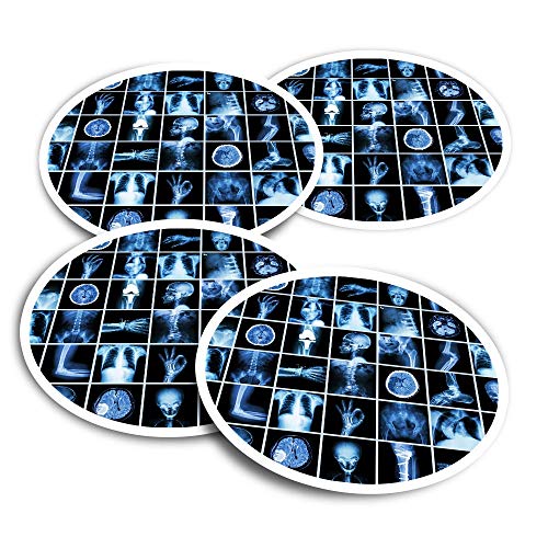 Pegatinas de vinilo (juego de 4) 10 cm – X-Ray CT Scan Doctor Nurse Hospital calcomanías divertidas para ordenadores portátiles, tabletas, equipaje, reserva de chatarra, frigoríficos #46477